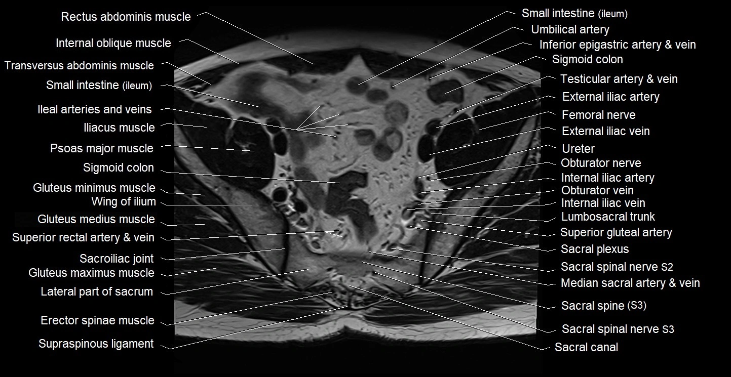 Male pelvis axial cross sectional anatomy image 10.webp
